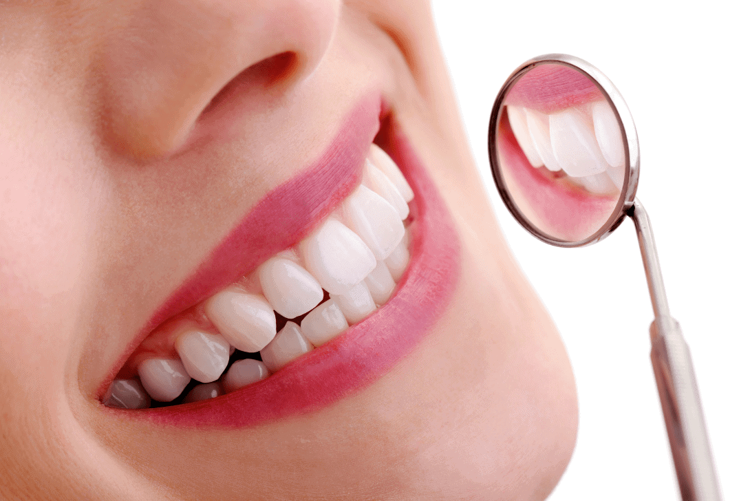 dental crowns - Markham dentists by 7 Days Dental