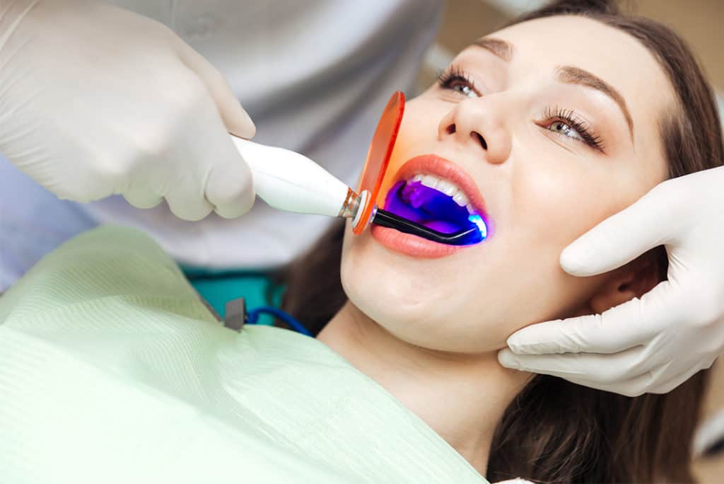 dental lasers - Markham dentists by 7 Days Dental