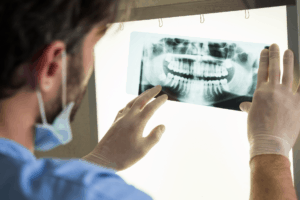 digital xray - Markham dentists by 7 Days Dental