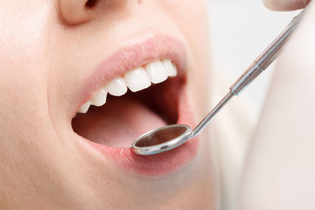 oral cancer screening - Markham dentists by 7 Days Dental