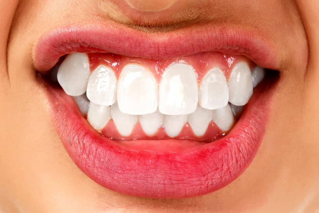 teeth grinding - Markham dentists by 7 Days Dental