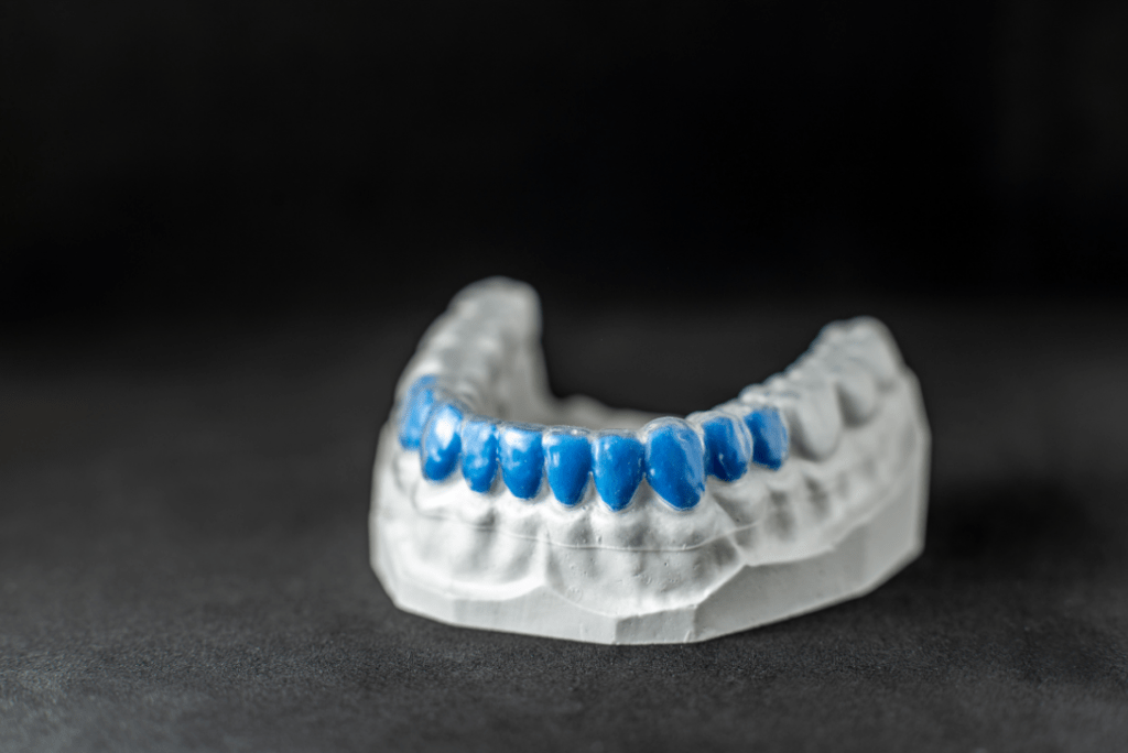 dental caps - Markham dentists by 7 Days Dental