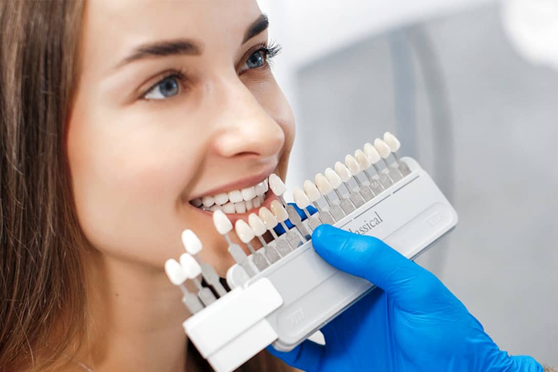 dental veneers - Markham dentists by 7 Days Dental