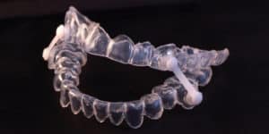 sleep apnea - Markham dentists by 7 Days Dental