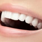 Teeth Whitening: Separating 5 Facts from Fiction In Markham